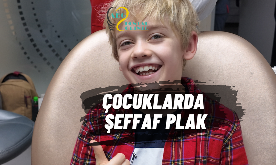 Çocuklarda Şeffaf Plak (Telsiz Ortodonti)