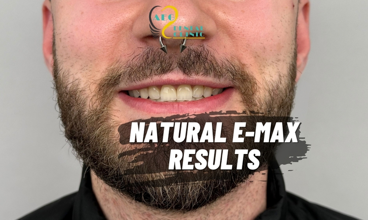 From California to Istanbul: David’s Journey to a Natural Smile