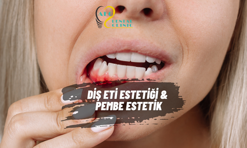 Diş Eti Estetiği & Pembe Estetik