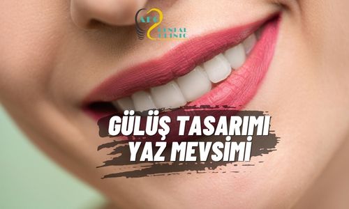Gülüş Tasarımı