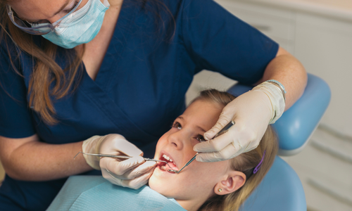 Fluoride Application