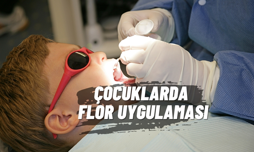 Çürüklere Karşı Kalkan: Florür ve Fissür Örtücü (Diş Aşısı)