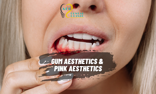 Gum Aesthetics & Pink Aesthetics