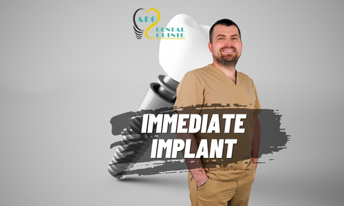 Single-Visit Smiles: Immediate Implant Procedure