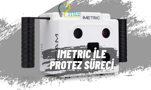 Sıfır Hata: Imetric Teknolojisi