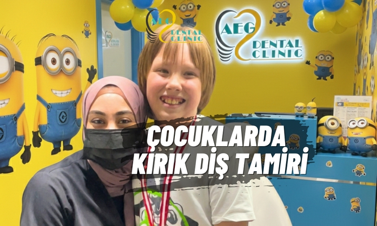 Kırık Diş Estetik Tamiri