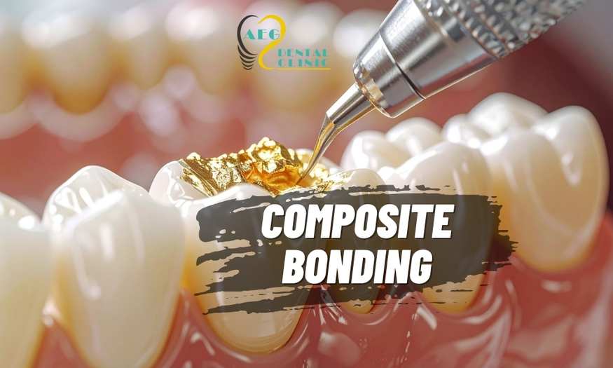 Perfect Smile, Zero Damage: Non-Invasive Makeover