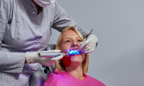 Laser Teeth Whitening