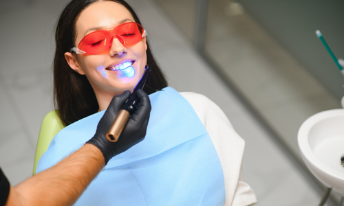 In-Office Teeth Whitening