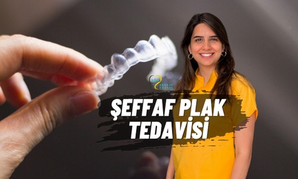 Şeffaf Plak Tedavisi