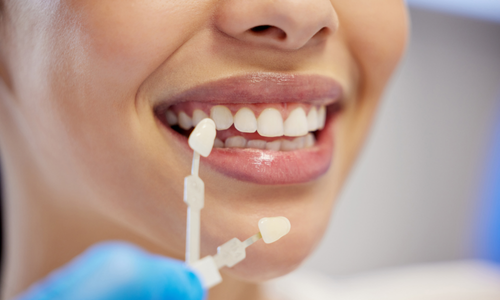 Zirconium Crowns